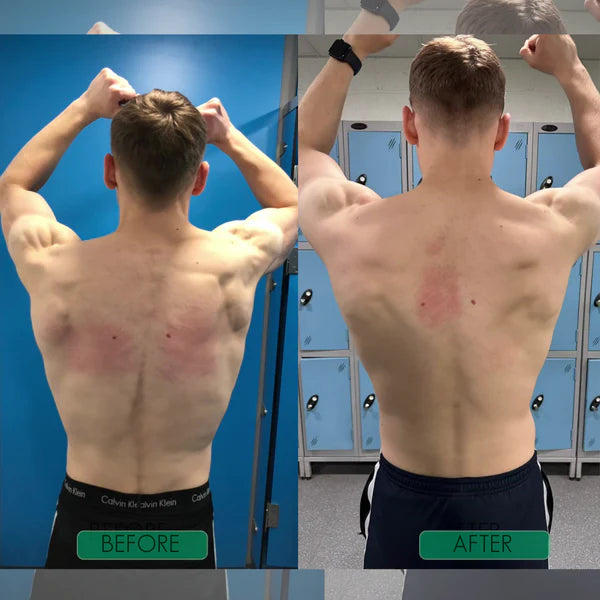 CORRECTOR DE POSTURA